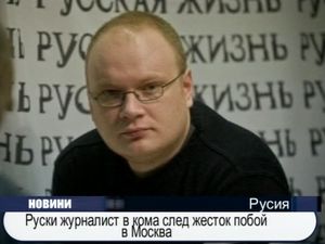  Руски журналист в кома след жесток побой в Москва